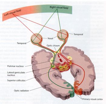 left visual field